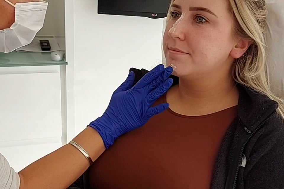 Rhinoplasty Treatment Video