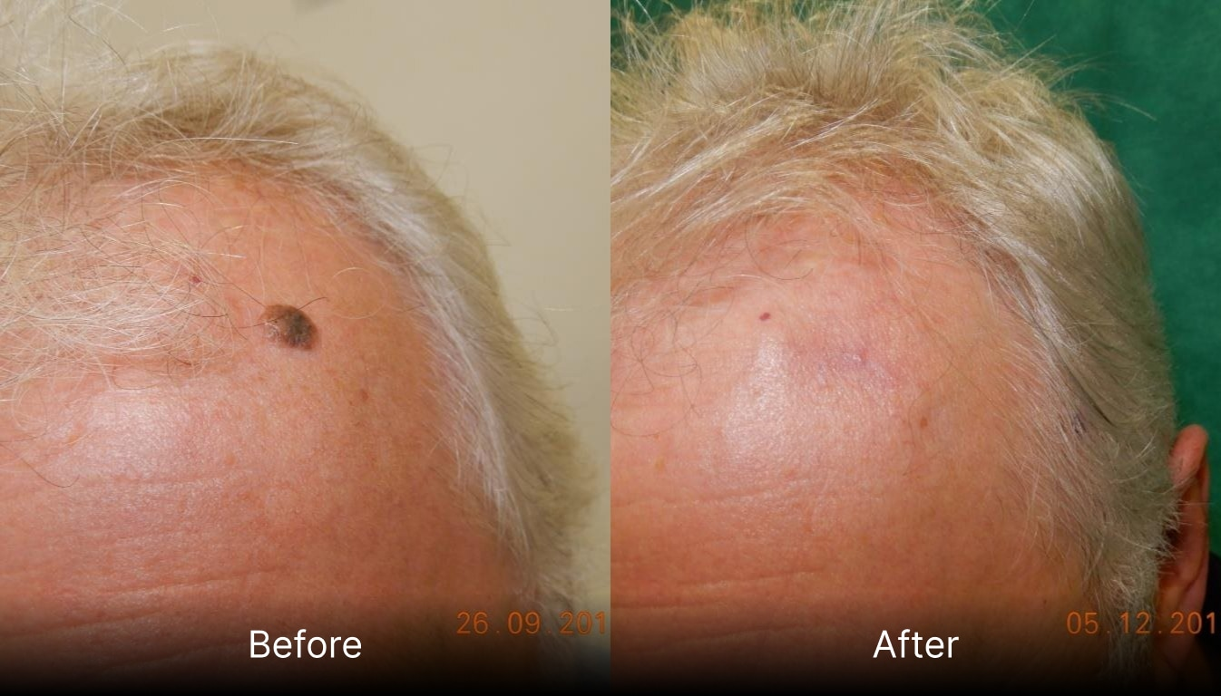 Before and after treatment results