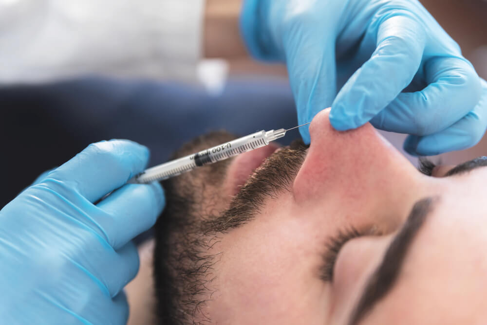 Non-Surgical Rhinoplasty: The Bridge-Tip Balance No One Explains