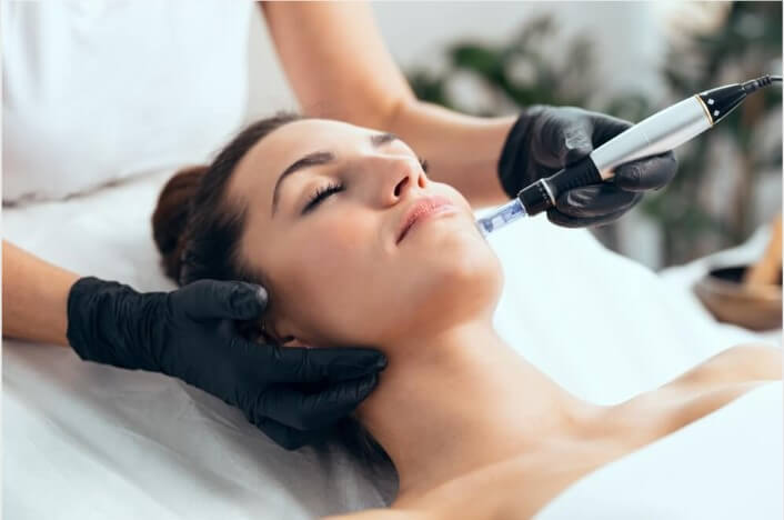 Derby Microneedling