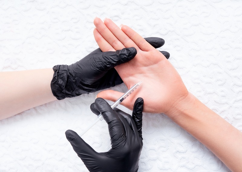 Excessive sweating treatment Derby
