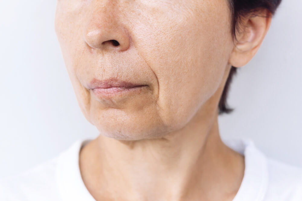Facial Aesthetics treatment