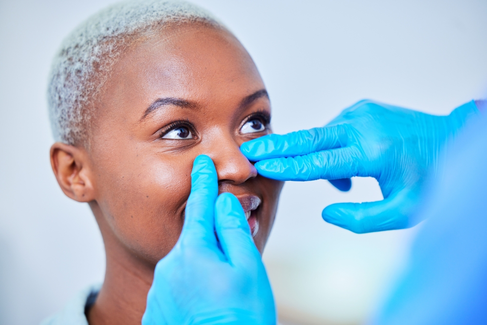 non-surgical rhinoplasty burton on trent