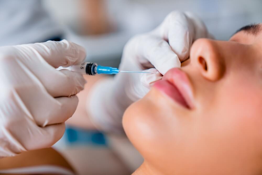 How Lip Fillers Can Balance Facial Features