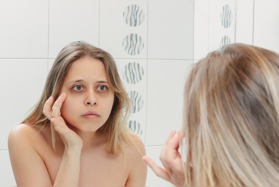 What exactly is an under-eye filler?