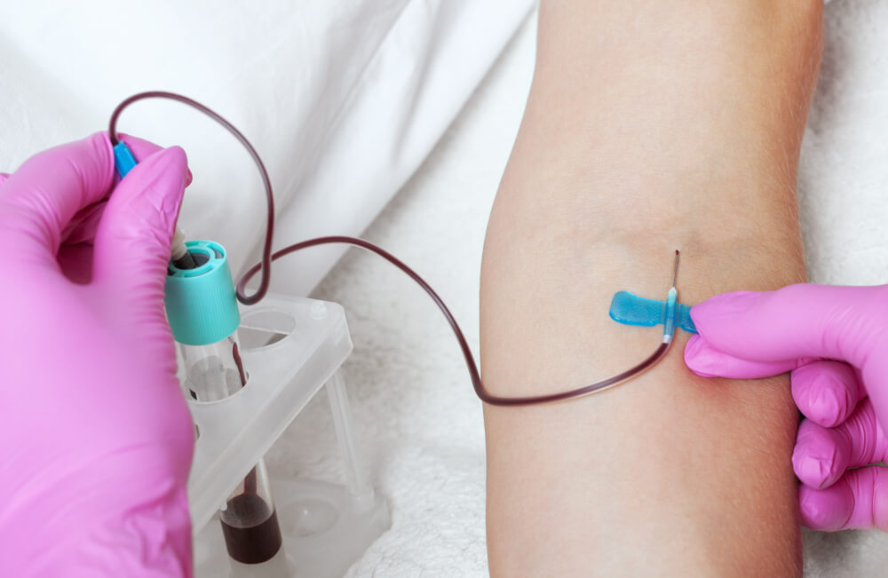 Platelet-Rich Plasma Treatment